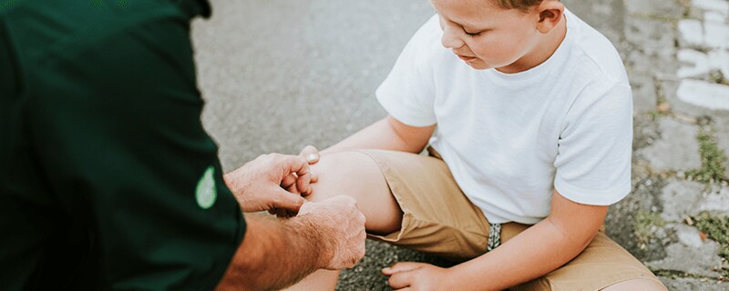 Treating Burns